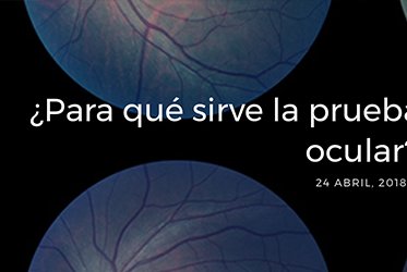 Para qu sirve la prueba de la angiografa ocular?